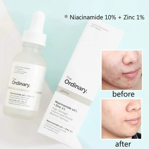 Ordinary Niacinamide 10%+Zinc 1% 30ml (PACK 1)
