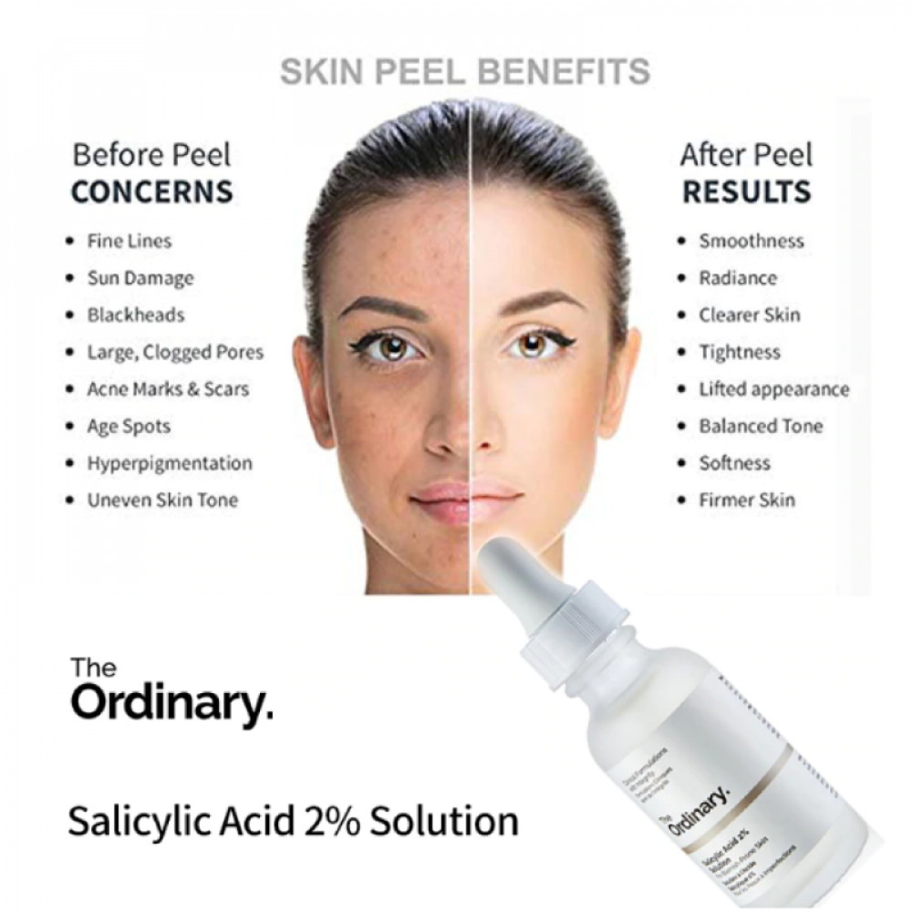 Buy 1 Get 1 Free, Ordinary Niacinamide 10% + Zinc 1% & Free Face Wash