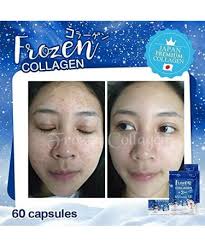 DEAL Frozen Collagen + 2 in 1 Whitening,60 Capsules, Made in Thailand