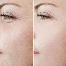 DEAL Frozen Collagen + 2 in 1 Whitening,60 Capsules, Made in Thailand