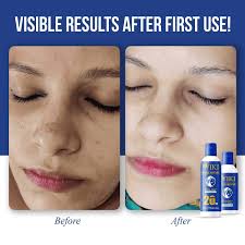 Combo Deal Wiki Special Skin Polish 40% OFF